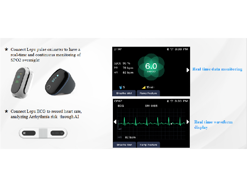 or datafanyifanyiVorteil Untersttzt tragbare BluetoothGerte, reduziert Kabel beschrnkungen Untersttz...