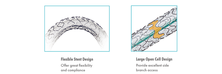 H-stent