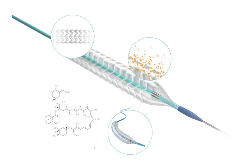 NeoVas™ Sirolimus-eluierendes Bioresorbierbares Coronary Scaffold System Details 